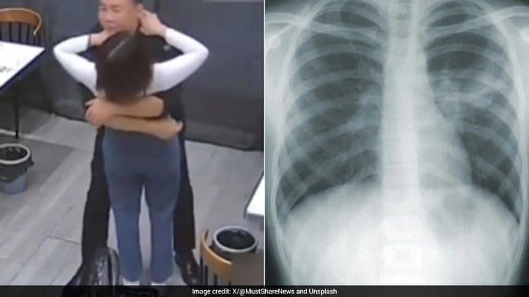 प्यार का 'ओवरडोज': जब बाहों के घेरे में टूट गईं पसलियाँ!